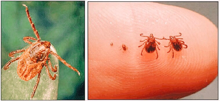 ticks and lyme disease