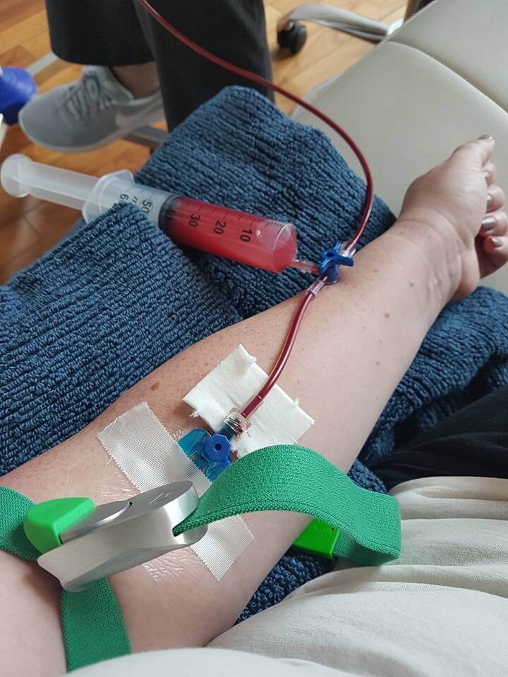 IV in a woman's arm, treatment for Lyme Disease