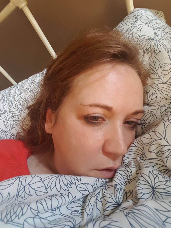 Woman in bed ill with lyme disease.