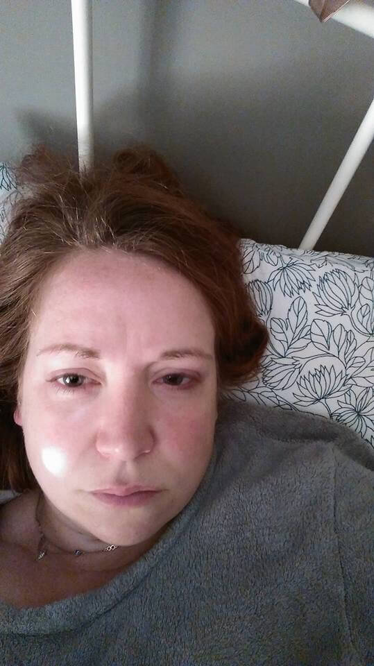 Woman sick in bed with lyme disease 